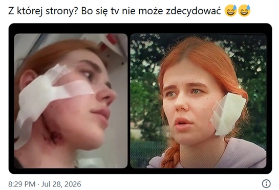 Tak wygląda opatrunek na twarzy pobitej we Wrocławu Anastazji (fot. X.com)